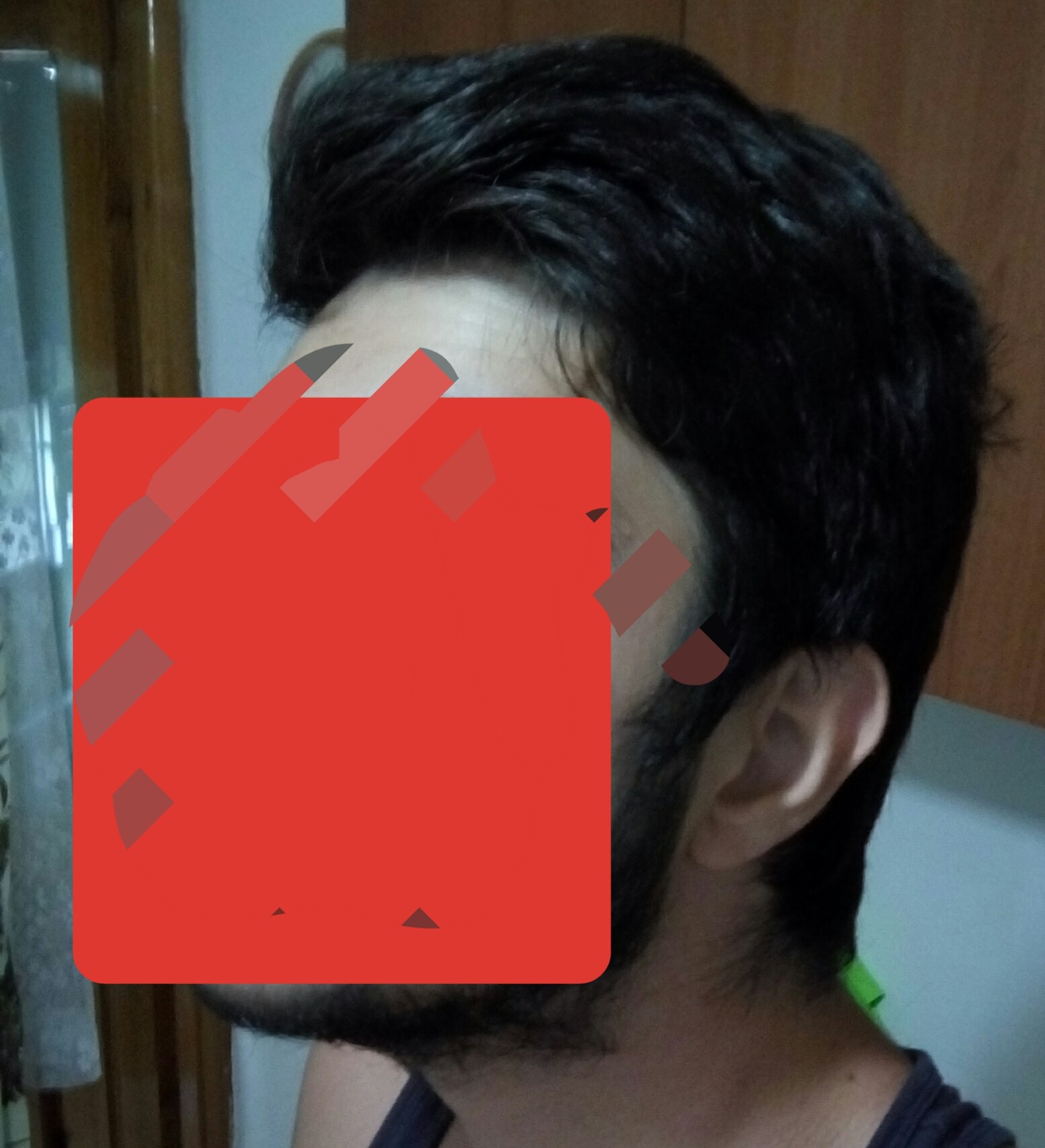 Saçlarım Dökülüyor Diyenler İçin Bir Öneri Saçlarım Dökülüyor Diyenler İçin Bir Öneri