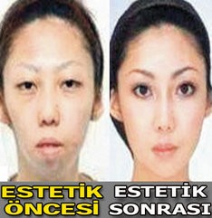  Çirkin Çocuk Doğurduğu İçin Karısına Dava Açtı SS'li