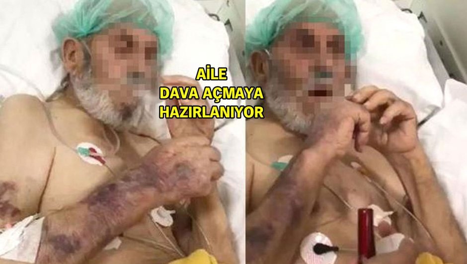 Sakarya'da yoğun bakım rezaletindeki yaşlı adam hayatını kaybetmiş