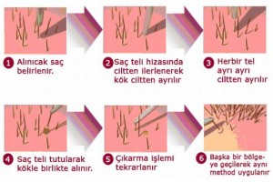 Ankara Saç Ekim Merkezi