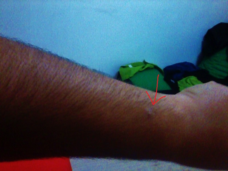  MAZOŞİSTİM SORULARI ALAYIM [CİDDİ]