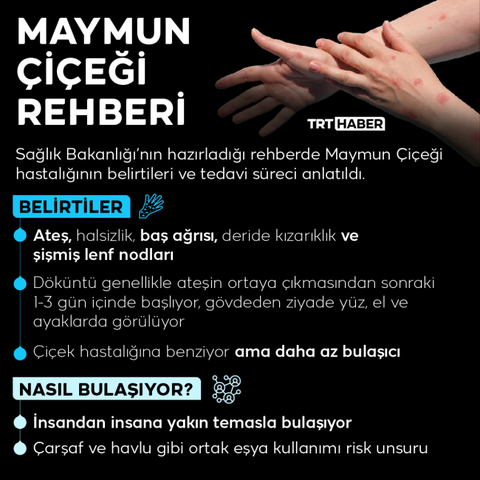 MAYMUN ÇİÇEĞİ VİRÜSÜ (MPOX) [ANA KONU]