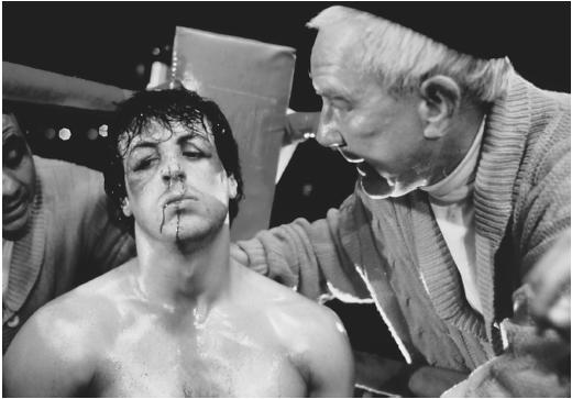  Acı Yok Rocky.