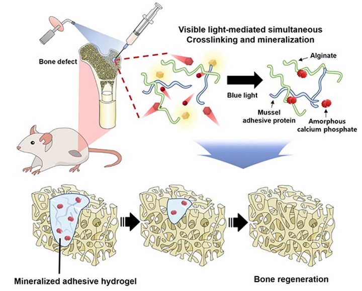 Kemik hastalıkları tedavisinde yeni çözüm: Görünür ışıkla sertleşen hidrojel