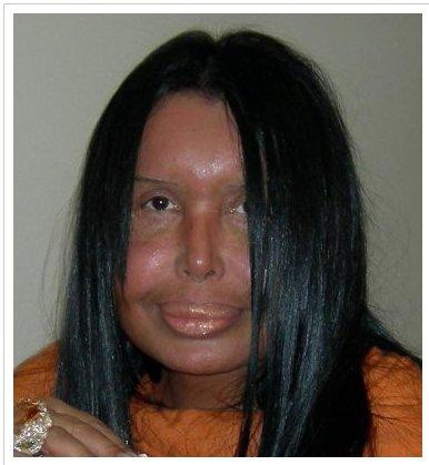 Steroid vurdum kısır kaldım