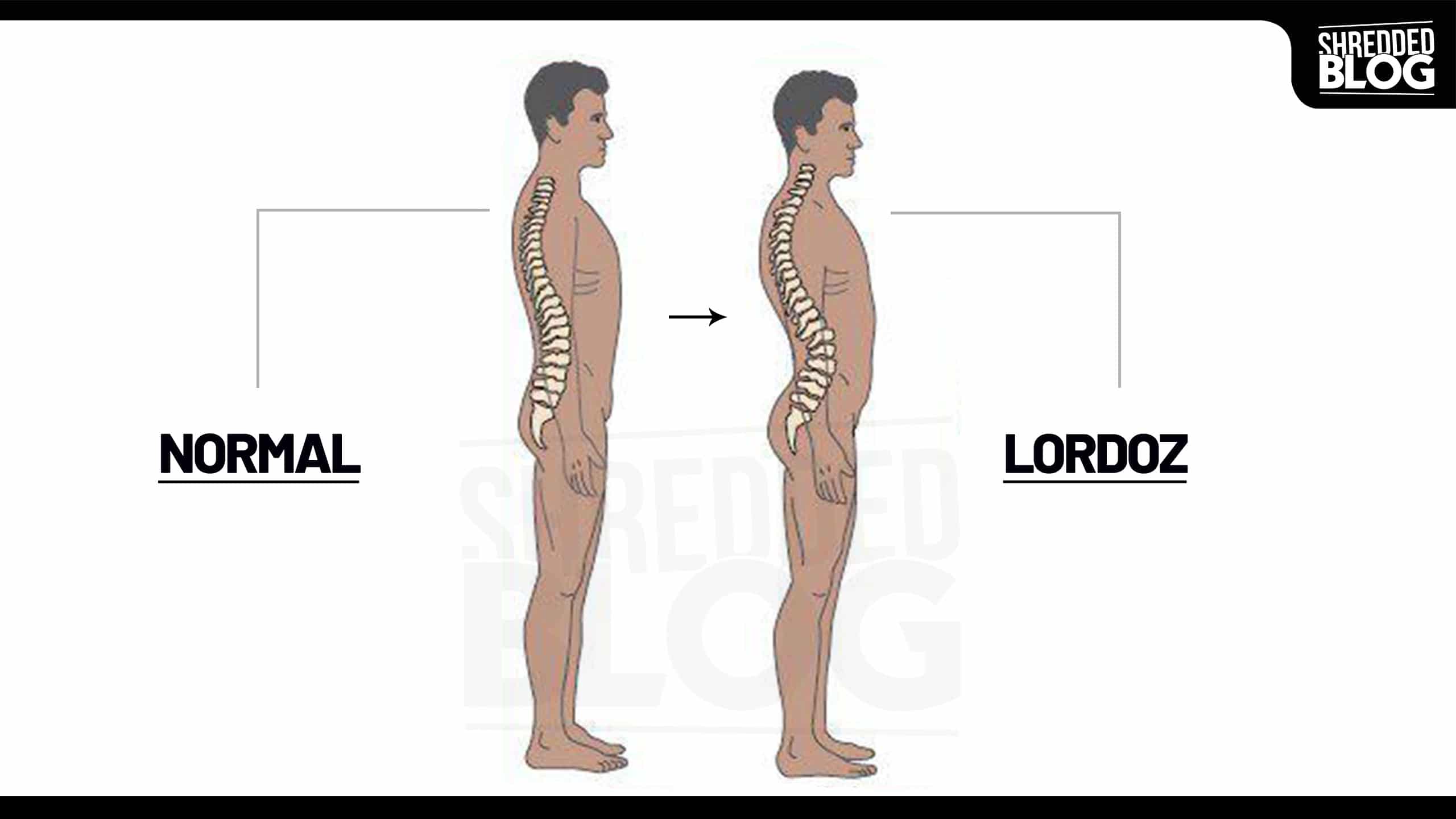 Lordoz (belim hafif içe doğru çökük)