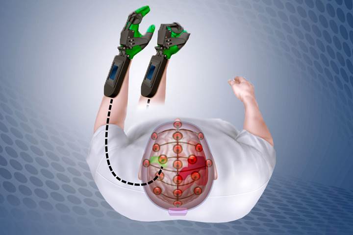 Felçli hastaların zihinle kontrol edebileceği robotik kol