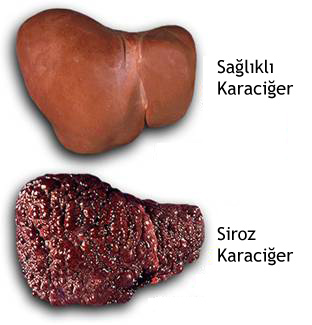  Evleneceğim insan içkiyi bırakmamı istiyor!