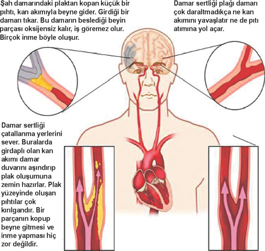  piercingi takarken damar patladı acil