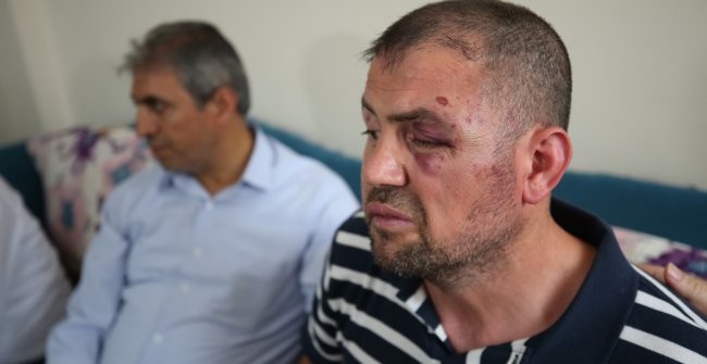 Bursa'da Irak Gazisini Hastanelik ettiler