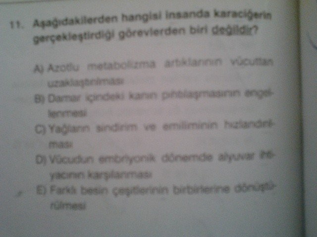  Sindirim Sistemi Soruları