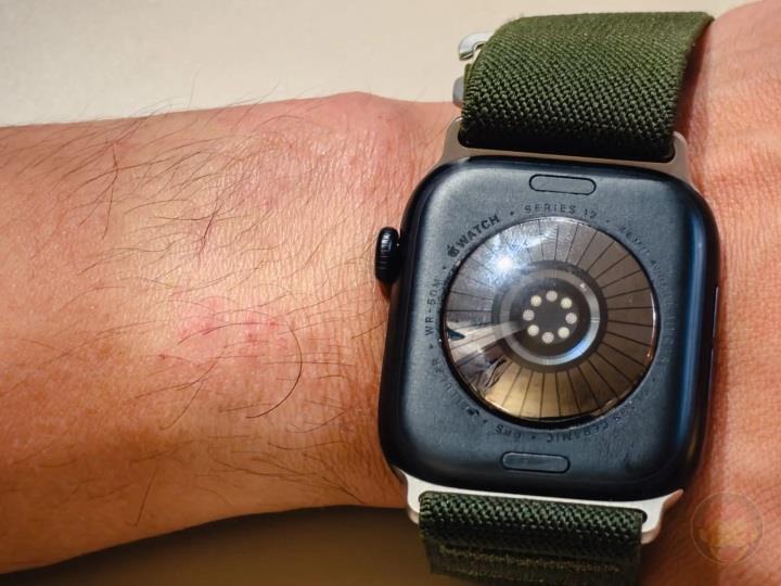 Yeni Apple Watch'lar cildi tahriş ediyor: Şikayetler artıyor!