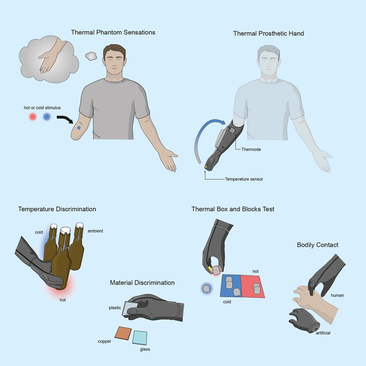 Bu devrimsel protez el, ampute kişinin sıcaklığı ve dokunuşu hissetmesini sağlıyor