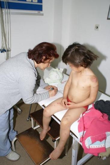  Bunu yapan anne olamaz (çocuğa işgence)