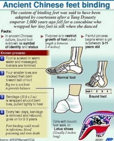 Chinese footbinding the history of a curious erotic custom