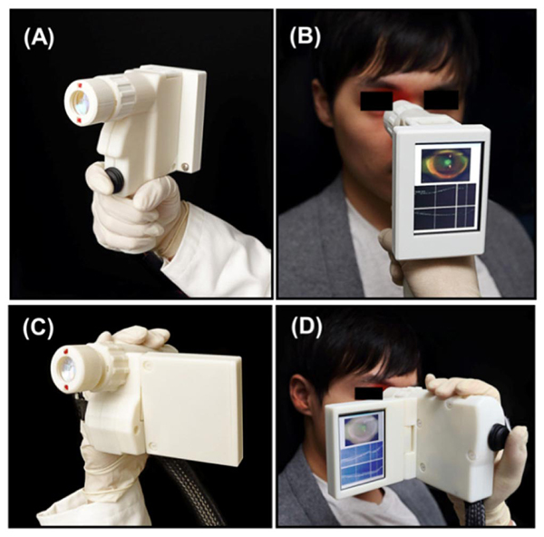 MIT, göz hastalıklarının tespiti için kompakt bir tarama cihazı geliştirdi