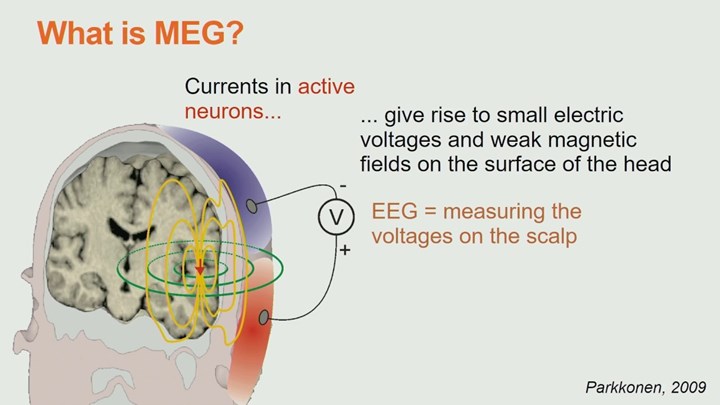 Beynin tamamını monitörize edebilen MEG kaskı geliştirildi