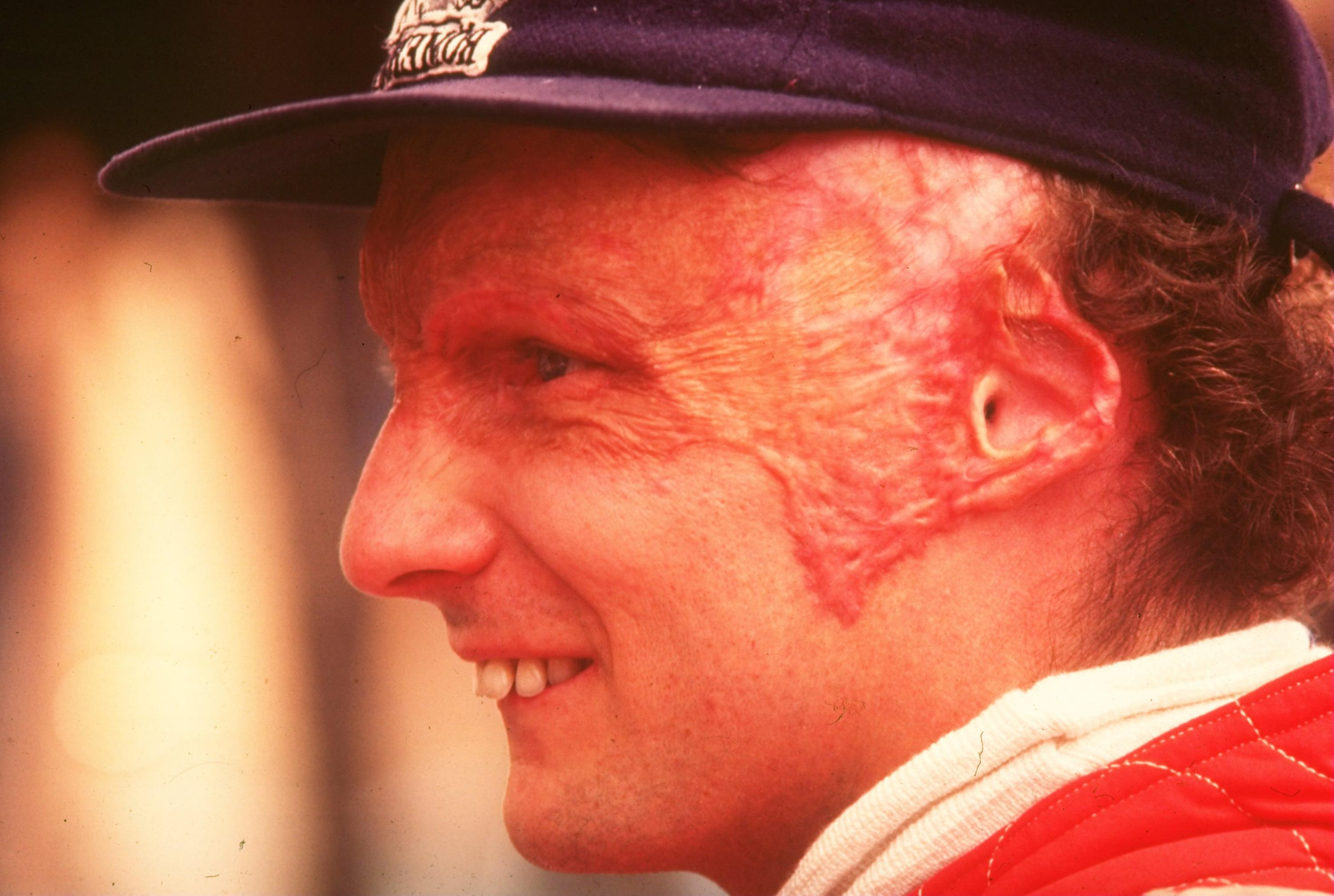 Efsanevi Formula 1 pilotu Niki Lauda hayatını kaybetti