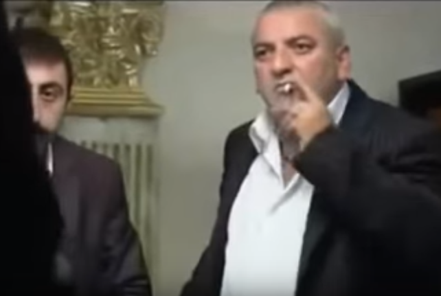Gözlerimi Çok Fazla Kırpıyorum