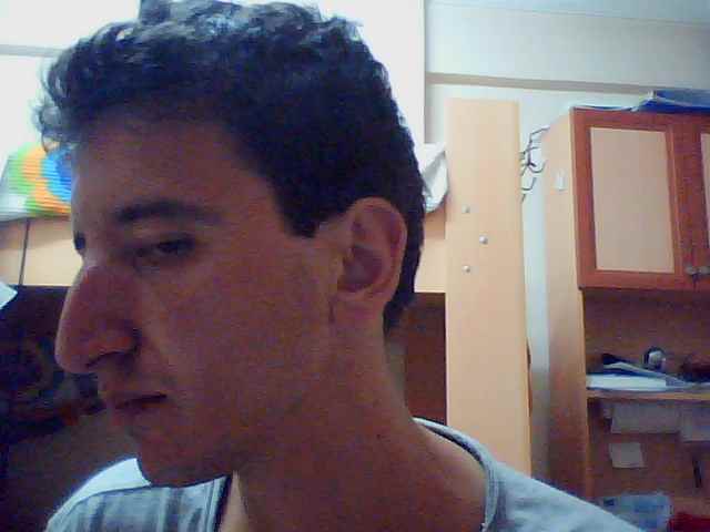  sizce burun estetigi olam mi ss li