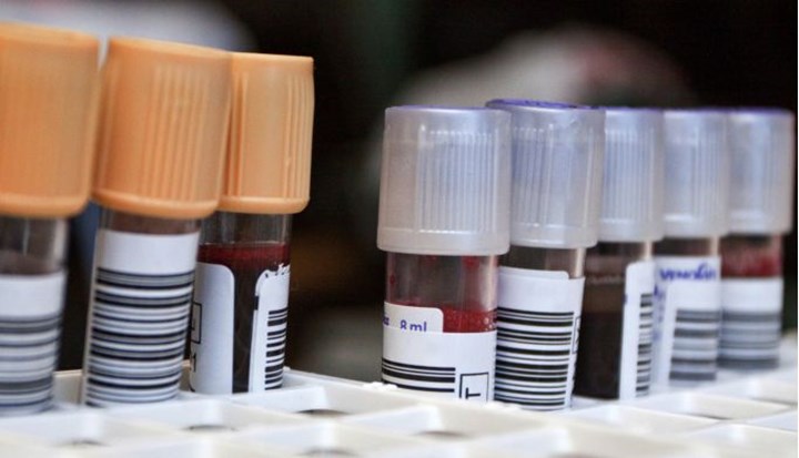 Amerika Birleşik Devletleri'nde ilk defa Alzheimer için kan testi kullanıma sunuldu