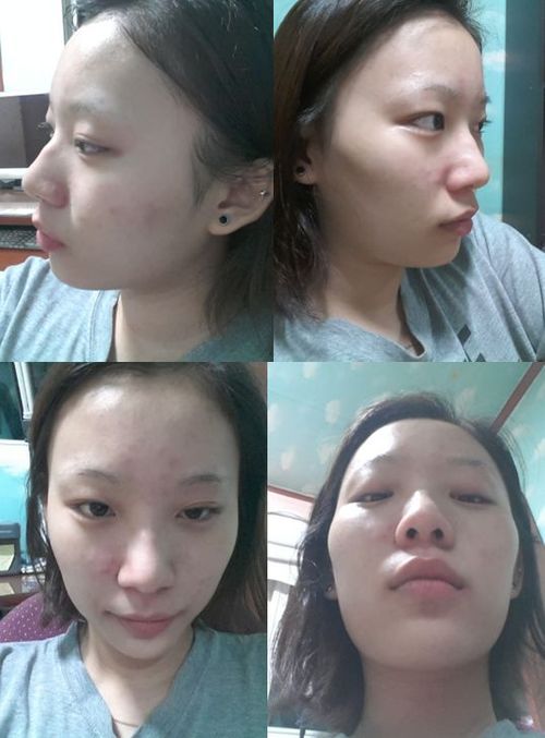  Dünya'nın En Güzel Bayanı Şuan LOL Oynuyor.