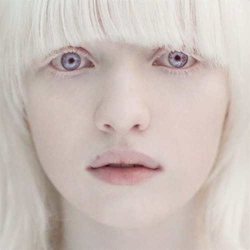  Albino Hastası Kızlara Bayılıyorum (SS'li)