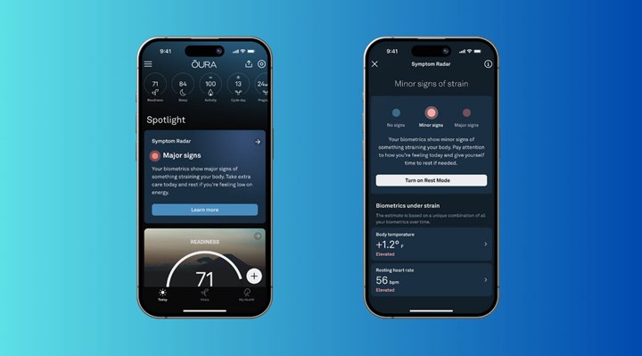 Oura akıllı yüzük, yeni özelliğiyle kişiyi hastalanmadan önce bilgilendirecek