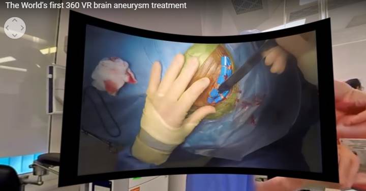 Dünyanın ilk VR beyin ameliyatı videosu