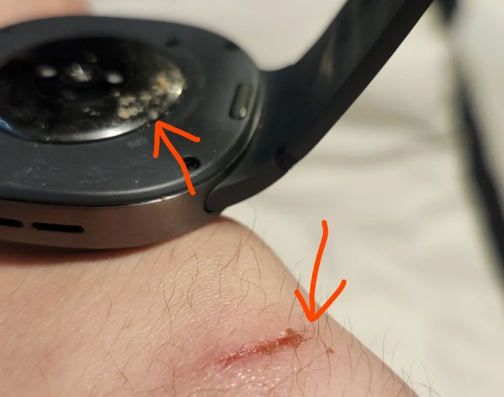 samsung galaxy watch 8 akıllı saat bilekte yanık