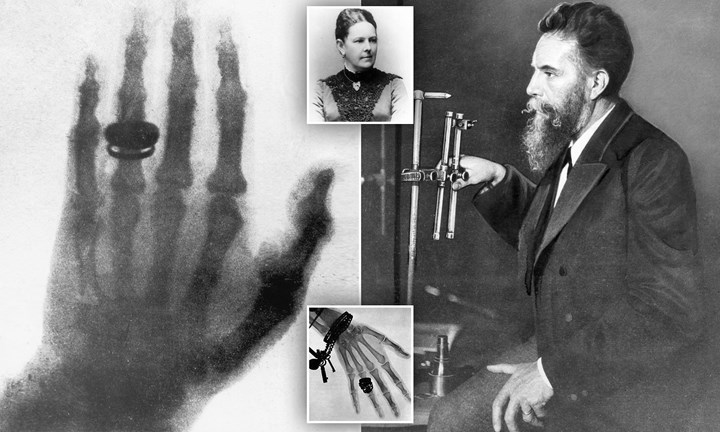 Taşınabilir X-ray cihazı geliştirildi