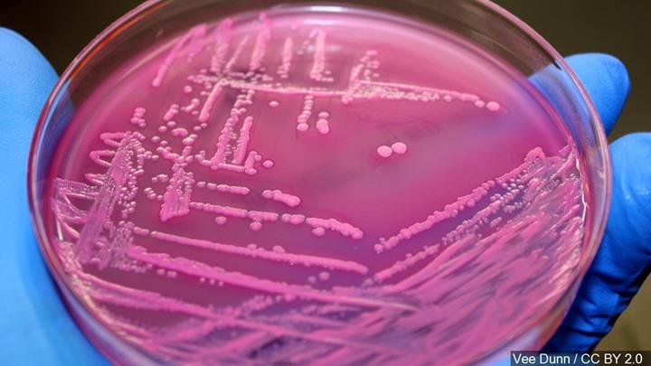 E. coli'nin enfeksiyon mekanizması aydınlatılıyor