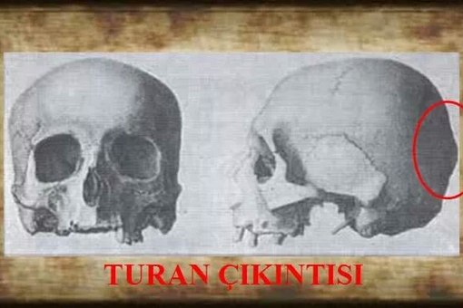  TUBERCULUM TURCUM (TURK KEMIGI)