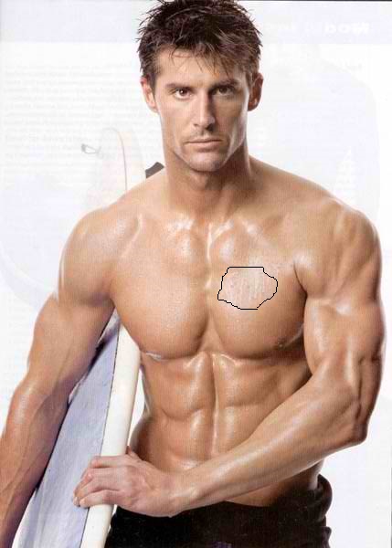  Gogus Sorunlarım Yardım (3 Sorun)