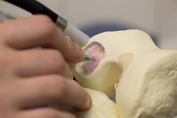 Cerrahlar için elde kullanılabilecek 3D yazıcı kalemi: BioPen