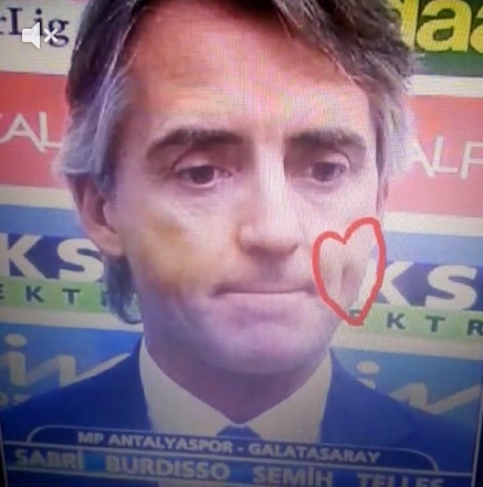  Mancini = Aykut Kocaman